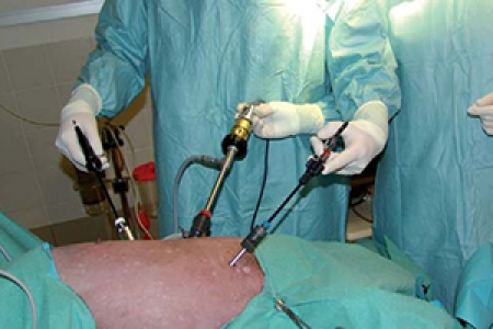 Intérêt de la laparoscopie dans le diagnostic des affections pancréatiques