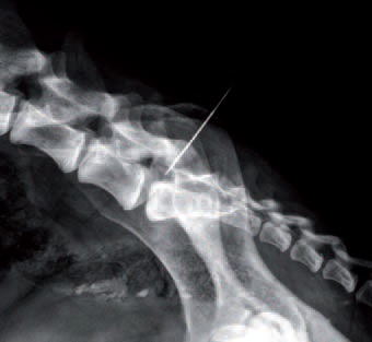 Photo 7 - Radiographie du patient avec l’aiguille in situ