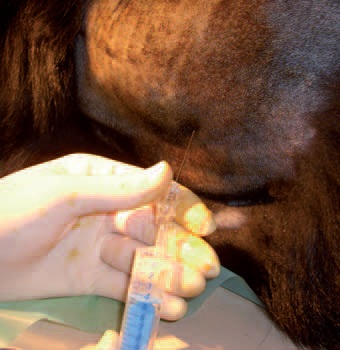 Photo 8 - Injection de l’anesthésique