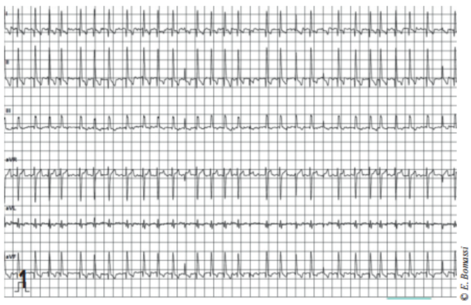 Examen électrocardiographique