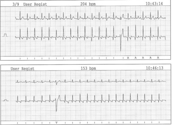 BOM - 2015 - Aa2b1 - Les cardiomyopathies dilatés du chien-encadré-2