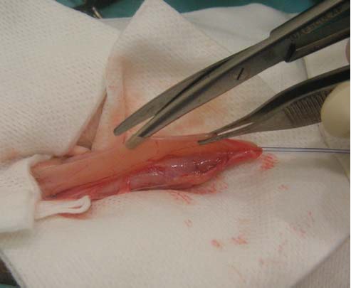 Photo 5 - Après une ponction à la lame de 11, l’incision de la vessie se fait avec des ciseaux de Metzenbaum.