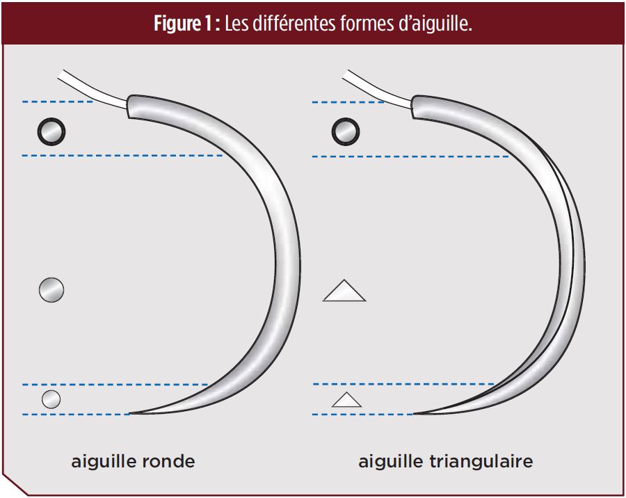 Choisir son aiguille