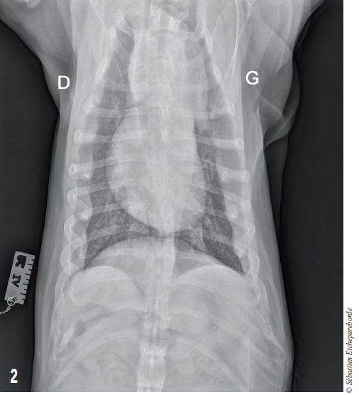 Photo 2 - Vue ventrodorsale du thorax