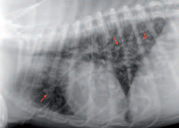 Photo 1 - Radiographie du thorax, profil gauche