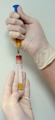 Photo 4 - Analyse d'urines