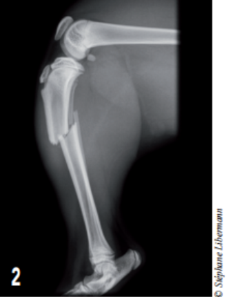 Photo 2 : Radiographie de profil du tibia