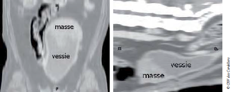 Photo 4 : Aspect tomodensitométrique de la masse vésicale en coupes frontale et sagittale.