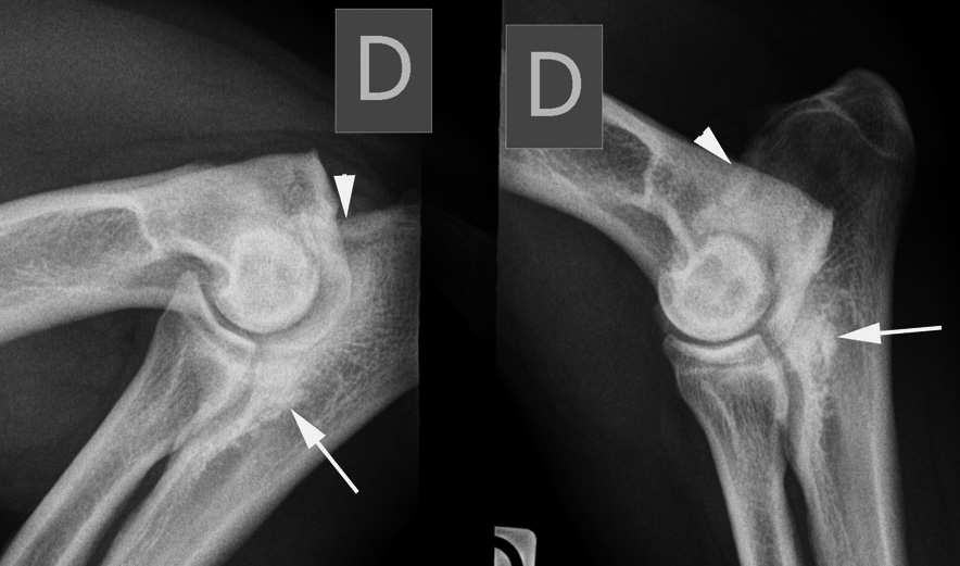 Photo 4 - Radiographies du coude de profil. Noter la présence de signes d’une dégénérescence arthrosique.