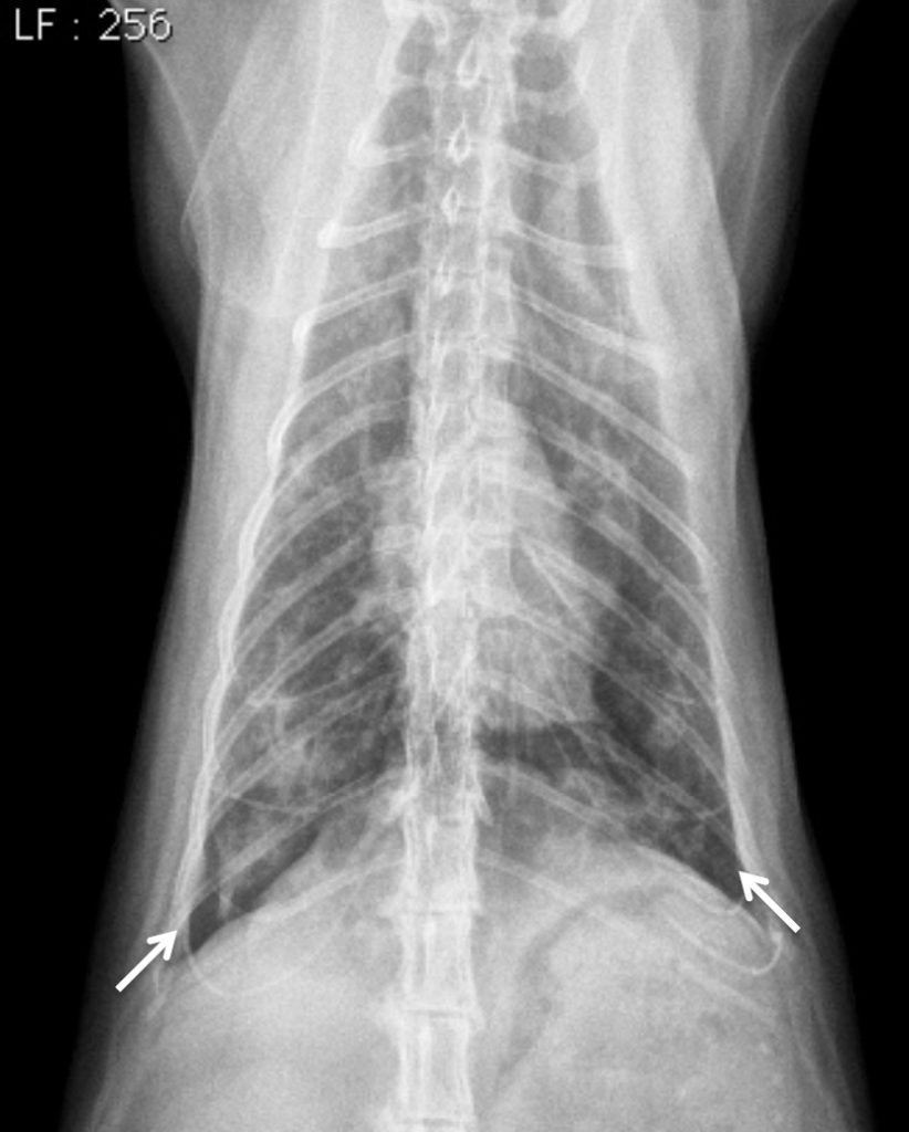 Photo 2 - Radiographie du thorax, vue de face.