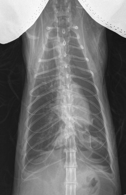 Photo 2 : Radiographie du thorax, vue de face