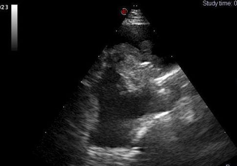 Photo 3 : Échographie du thorax