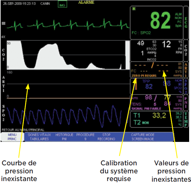 Photo 7 - Calibration