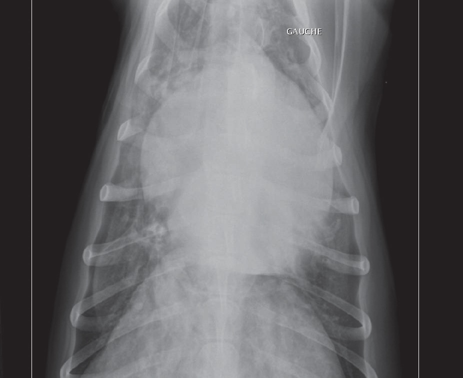 Cardiology dorso-ventral thoracic radiograph: cardiomegaly and alveolar pulmonary oedema.